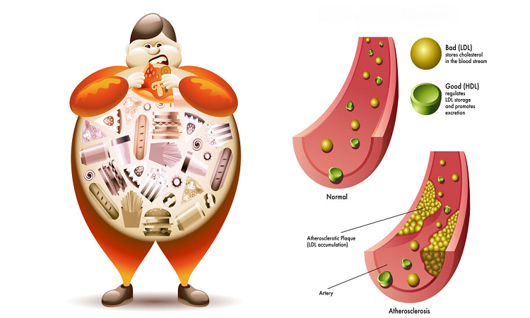 کلسترول خوب، کلسترول بد: ۱۰ تغییر رژیمی برای تنظیم پروفایل چربی خون.