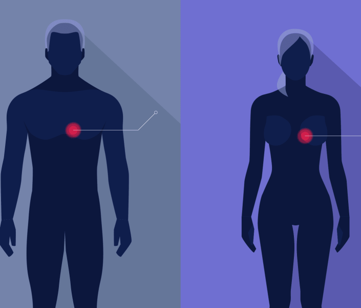 تفاوت سکته قلبی در زنان و مردان